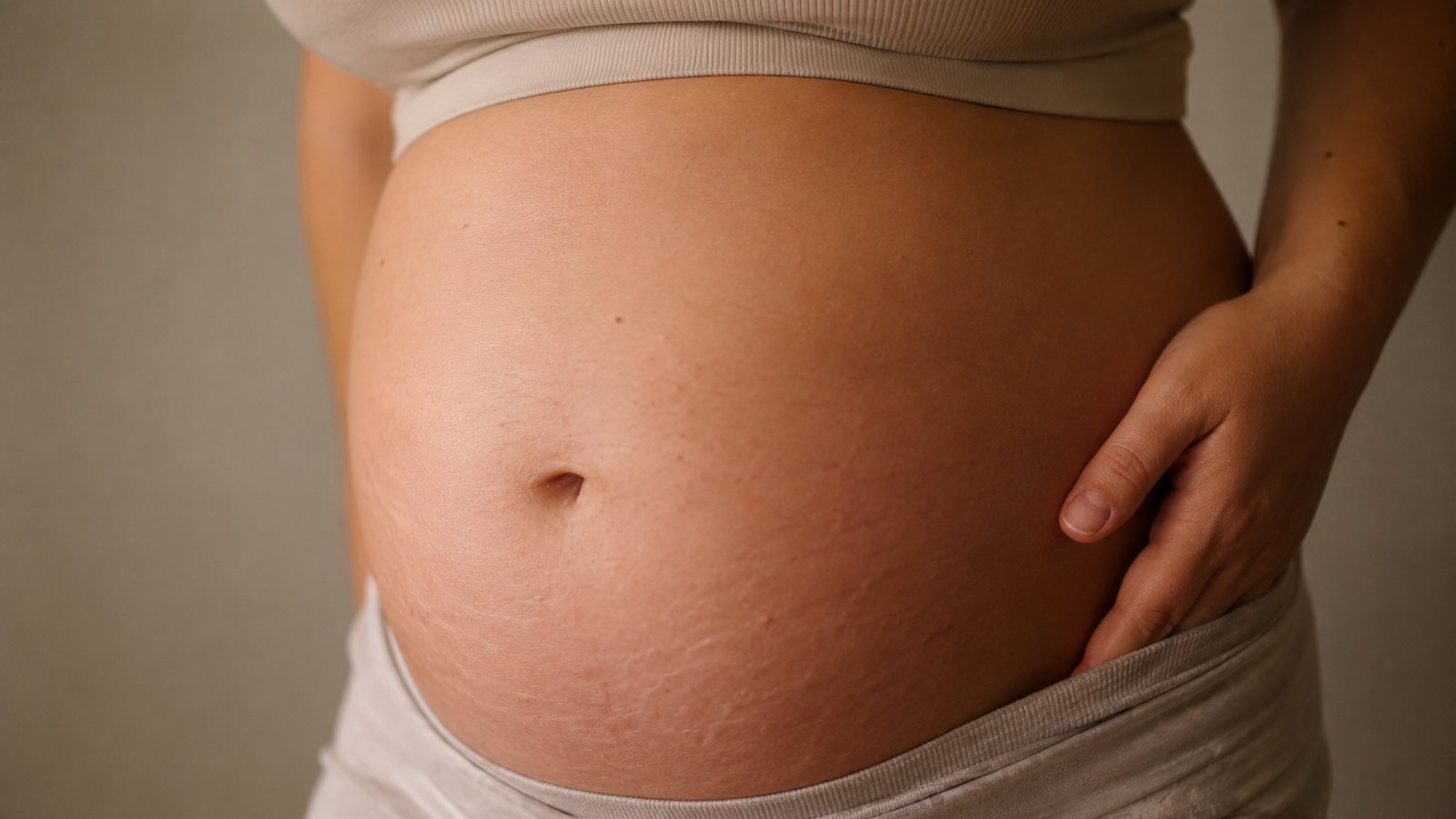 Close-up of a pregnancy bump with faded stretch marks across the lower stomach